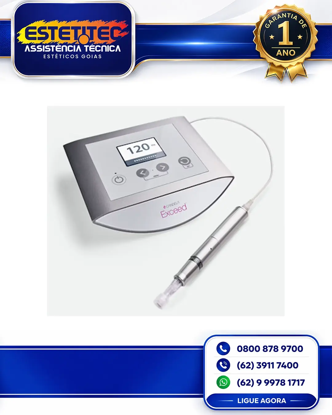 REPARO DE CANDELA EXCEED SÃO PAULO